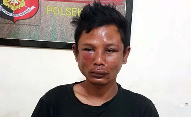 Gondol Motor Pelajar Turen, Pipi Samot Pagelaran Bengkak Memerah